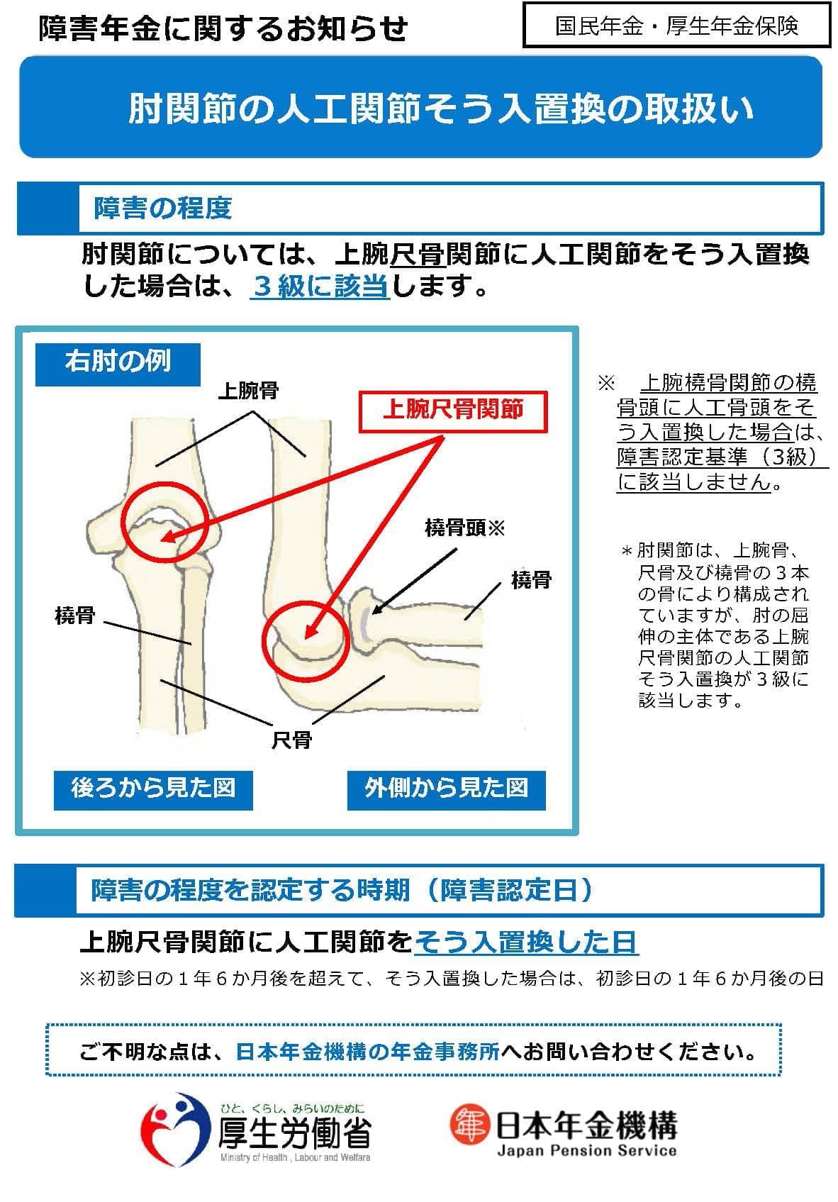 肘関節の人工関節そう入置換の取り扱いパンフレット